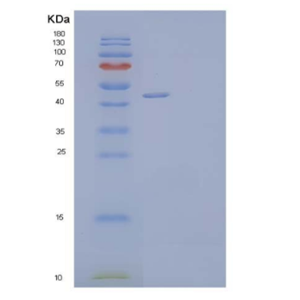 Recombinant Human Testin/TES Protein(C-6His),Recombinant Human Testin/TES Protein(C-6His)