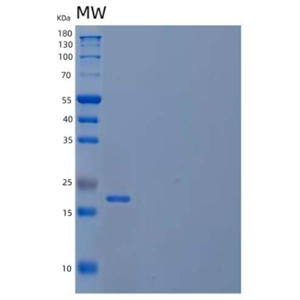 Recombinant Human Heat Shock Protein β-7/HSPB7 Protein(C-6His)