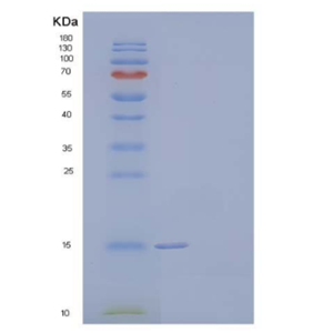 Recombinant Human Hemoglobin Subunit α/HBA1 Protein(N-6His)