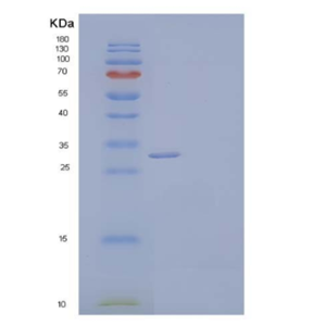 Recombinant Human CLEC10A/CD301 Protein(C-6His),Recombinant Human CLEC10A/CD301 Protein(C-6His)