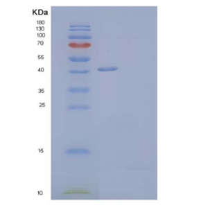 Recombinant Human Nogo-66 Receptor-Related 3/NgR3/RTN4RL1 Protein(C-6His)