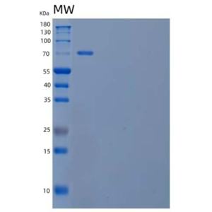 Recombinant Human Neuroligin 4, X-Linked/NLGN4X Protein(C-6His),Recombinant Human Neuroligin 4, X-Linked/NLGN4X Protein(C-6His)