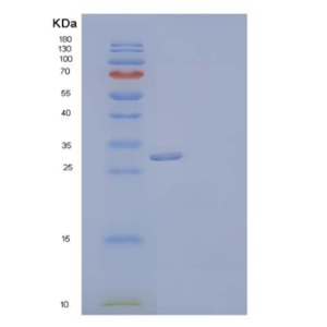 Recombinant Human CGREF1/CGR11 Protein(C-6His),Recombinant Human CGREF1/CGR11 Protein(C-6His)