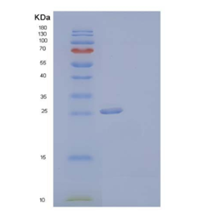 Recombinant Human Coagulation Factor III/Tissue Factor/CD142 Protein(C-6His)