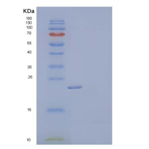 Recombinant Human High Mobility Group Protein B3/HMGB3 Protein(C-6His),Recombinant Human High Mobility Group Protein B3/HMGB3 Protein(C-6His)