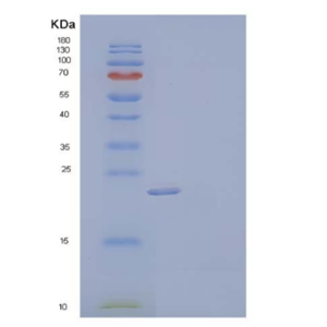 Recombinant Human High Mobility Group Protein B3/HMGB3 Protein(C-6His)