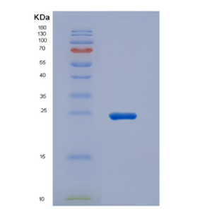 Recombinant High Mobility Group Protein 1 (HMGB1),Recombinant High Mobility Group Protein 1 (HMGB1)