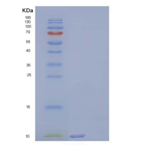 Recombinant Human Complement Component C3a/C3a Protein,Recombinant Human Complement Component C3a/C3a Protein