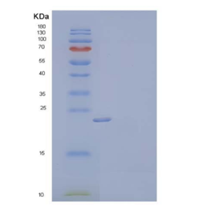 Recombinant Mouse Fibroblast Growth Factor 17/FGF-17 Protein(C-6His)