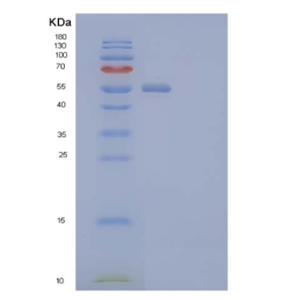 Recombinant Human Host Cell Factor 2/HCFC2 Protein(N-6His),Recombinant Human Host Cell Factor 2/HCFC2 Protein(N-6His)