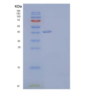 Recombinant Human THSD1/TMTSP Protein(C-6His)