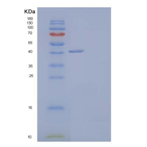 Recombinant Human Hyaluronidase-1/HYAL1 Protein(C-6His),Recombinant Human Hyaluronidase-1/HYAL1 Protein(C-6His)