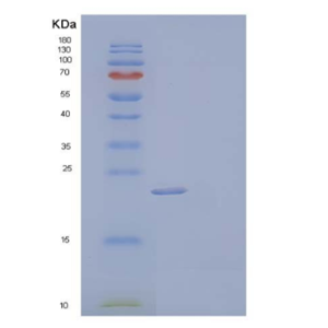 Recombinant Human Complement Component C8 γ Chain/C8G Protein(N-6His)