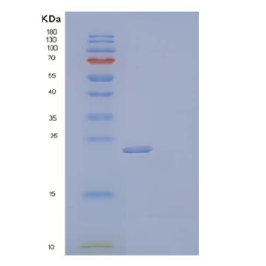 Recombinant Mouse Fibroblast Growth Factor 9/FGF-9Protein(C-6His)