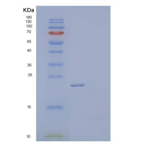 Recombinant Human Tissue Inhibitor of Metalloproteinases 2/TIMP-2 Protein(C-6His)