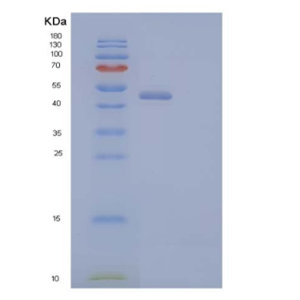 Recombinant Human Corneodesmosin/CDSN Protein(C-6His)