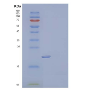 Recombinant Mouse Fms-LikeTyrosine Kinase 3 Ligand/FLT3LG Protein(C-6His)