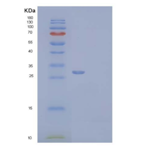 Recombinant Human Complement Factor H-Related Protein 2/CFHR2 Protein(C-6His),Recombinant Human Complement Factor H-Related Protein 2/CFHR2 Protein(C-6His)