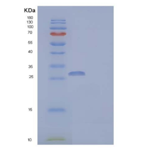 Recombinant Human Coronin-6/CORO6 Protein(N-6His),Recombinant Human Coronin-6/CORO6 Protein(N-6His)