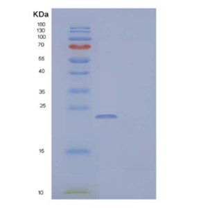 Recombinant Mouse IGF Binding Protein 6/IGFBP-6 Protein(C-6His)