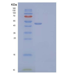 Recombinant Human Ornithine Decarboxylase/ODC1 Protein(C-6His, N-T7 tag)