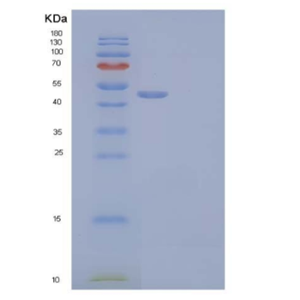 Recombinant Human Ornithine Decarboxylase/ODC1 Protein(C-6His, N-T7 tag),Recombinant Human Ornithine Decarboxylase/ODC1 Protein(C-6His, N-T7 tag)