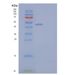 Recombinant Human Pancreatic Lipase-Related Protein 2/PLRP2 Protein(C-6His)
