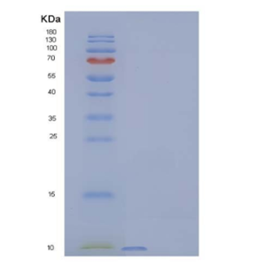 Recombinant Human C-X-C Motif Chemokine 1/CXCL1 Protein(C-6His)