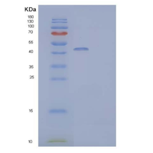 Recombinant Human IL-22 Receptor Subunit α2/IL-22BP/IL-22RA2 Protein(C-Fc)