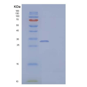 Recombinant Human Interleukin-12 Subunit β/IL-12 p40/IL-12B Protein
