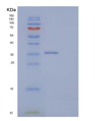 Recombinant Human Cyclin-D2/CCND2 Protein(N-6His),Recombinant Human Cyclin-D2/CCND2 Protein(N-6His)