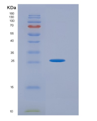 Recombinant Tumor Necrosis Factor Ligand Superfamily, Member 9 (TNFSF9),Recombinant Tumor Necrosis Factor Ligand Superfamily, Member 9 (TNFSF9)