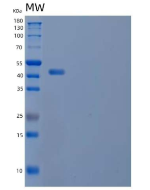 Recombinant Mouse Interleukin-22/IL-22 Protein(C-mFc),Recombinant Mouse Interleukin-22/IL-22 Protein(C-mFc)