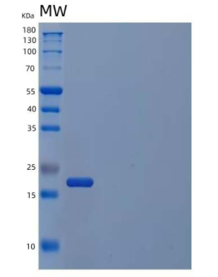 Recombinant Human Myc-Associated Factor X Protein,Recombinant Human Myc-Associated Factor X Protein