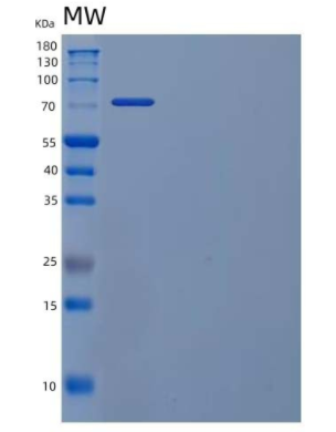 Recombinant Human Phosphofructokinase 1/PFKM/PFKX Protein(C-6His),Recombinant Human Phosphofructokinase 1/PFKM/PFKX Protein(C-6His)