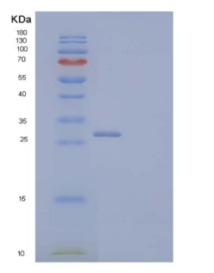 Recombinant Human Endoplasmic Reticulum Resident Protein 27 Protein,Recombinant Human Endoplasmic Reticulum Resident Protein 27 Protein