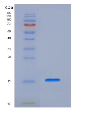 Recombinant Human PH-Like Domain A2/PHLDA2/BWR1C/IPL/TSSC3 Protein(C-6His),Recombinant Human PH-Like Domain A2/PHLDA2/BWR1C/IPL/TSSC3 Protein(C-6His)