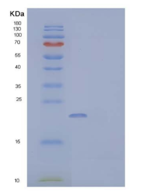 Recombinant Human Fatty Acid-Binding Protein 5 Protein,Recombinant Human Fatty Acid-Binding Protein 5 Protein