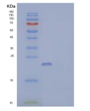 Recombinant Human Cytoglobin/CYGB Protein(C-6His),Recombinant Human Cytoglobin/CYGB Protein(C-6His)