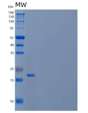 Recombinant Mouse Interleukin-18/IL-18/IL-1F4 Protein(N-6His),Recombinant Mouse Interleukin-18/IL-18/IL-1F4 Protein(N-6His)