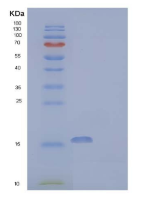Recombinant Human Acyl-Coenzyme A Thioesterase 13/ACOT13 Protein(C-6His),Recombinant Human Acyl-Coenzyme A Thioesterase 13/ACOT13 Protein(C-6His)