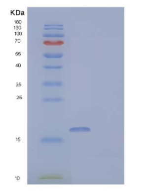 Recombinant Human Fatty Acid-Binding Protein 3 Protein,Recombinant Human Fatty Acid-Binding Protein 3 Protein