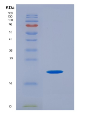 Eukaryotic Interleukin 17F (IL17F),Eukaryotic Interleukin 17F (IL17F)