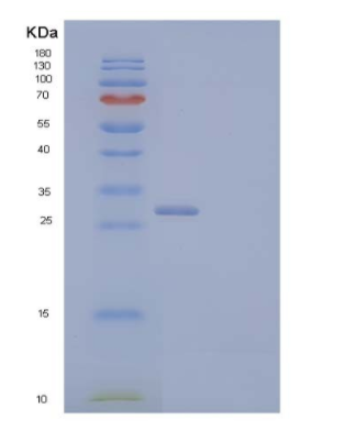 Recombinant Human Vesicular Integral-Membrane Protein VIP36 Protein,Recombinant Human Vesicular Integral-Membrane Protein VIP36 Protein