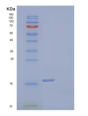 Recombinant Human Interleukin-17F/INHAProtein(C-6His),Recombinant Human Interleukin-17F/INHAProtein(C-6His)