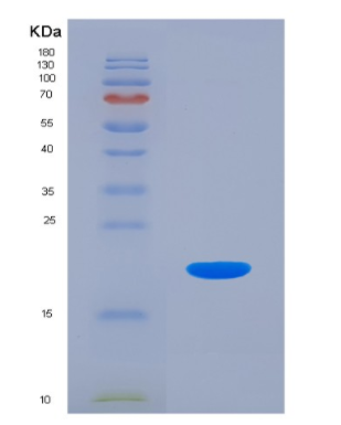 Eukaryotic Interleukin 18 (IL18),Eukaryotic Interleukin 18 (IL18)