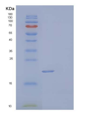 Recombinant Mouse Lithostathine-2/Reg2 Protein(N-6His),Recombinant Mouse Lithostathine-2/Reg2 Protein(N-6His)