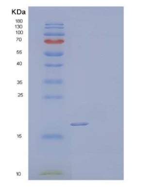 Recombinant Human Interleukin-1β/IL-1β Protein,Recombinant Human Interleukin-1β/IL-1β Protein