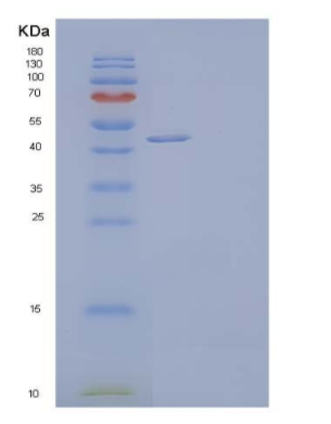 Recombinant Human Deoxyhypusine Synthase/DHS Protein(C-6His),Recombinant Human Deoxyhypusine Synthase/DHS Protein(C-6His)