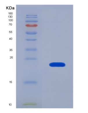 Eukaryotic Interleukin 22 (IL22),Eukaryotic Interleukin 22 (IL22)